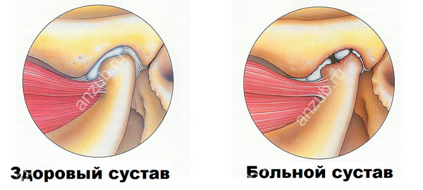 челюсть